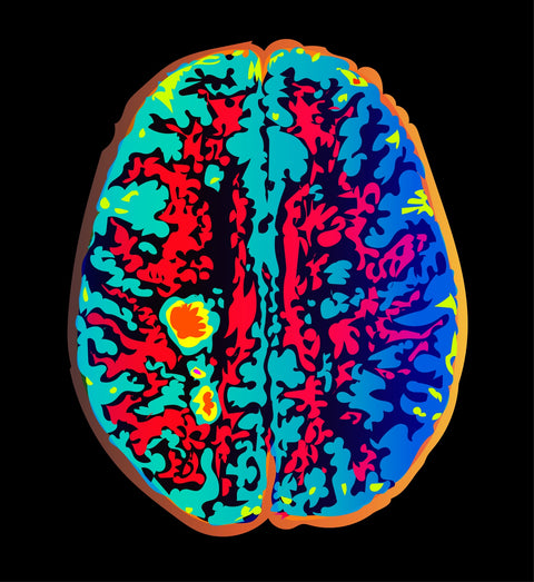 Brain Scan Wall Art