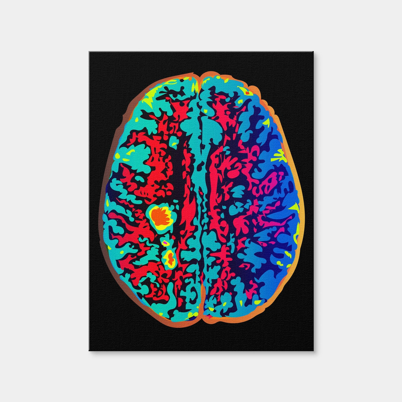 AUTO-MOCKUP WHITE | Brain Scan | 1 Piece | Gallery Wrap Canvas | group=3x4