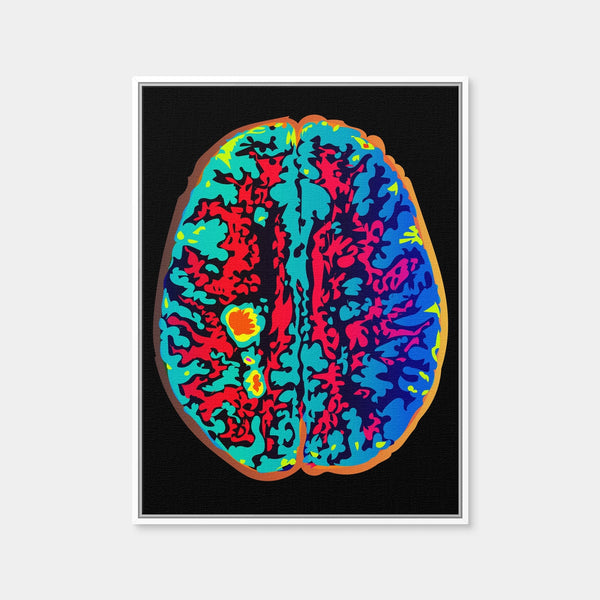 Brain Scan Wall Art — Framed Canvas Format preview